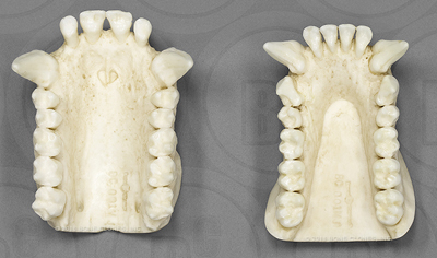 Western Lowland Gorilla Maxilla and Mandible, Male