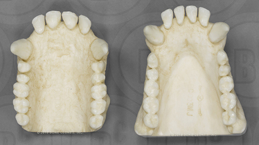 Chimpanzee Maxilla and Mandible, Male