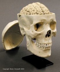 Human Male Asian Skull, Calvarium Cut with Brain and Stand