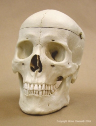Human Male Asian Skull, Calvarium Cut