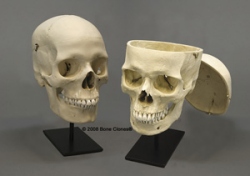 Human Male and Female Calvarium Cut Skulls Comparative Set (European male & European female)