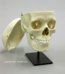Human Female European Skull, Calvarium Cut