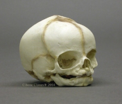 Human Fetal Skull 31 weeks