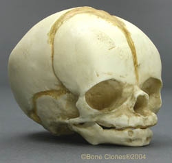 Human Fetal Skull 32 weeks