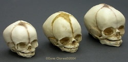 Human Fetal Skulls, Set of 3 