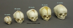 Human Fetal Skulls, Set of 5