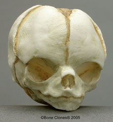 Human Fetal Skull 20 weeks