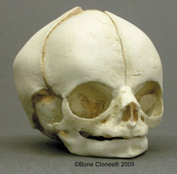 Human Fetal Skull 29 weeks
