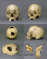 Human Female Skull, Shotgun holes