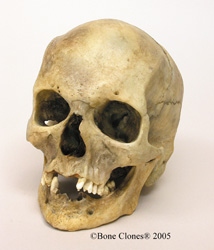 Human Masculinized Skull
