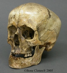Human Roman Gladiator Skull- 50-100BC