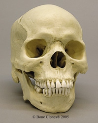 Human Male African-American Skull