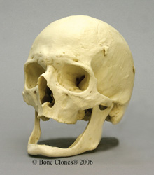 Human Male European, Elderly Skull 
