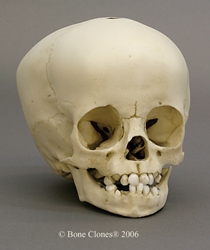 Human Child Skull 16-month-old (16-18 months)