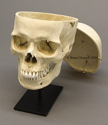 Human Male European Skull, Calvarium Cut 