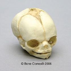 Human Fetal Skull 21 1/2 weeks