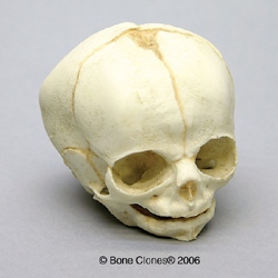 Human Fetal Skull 30 weeks