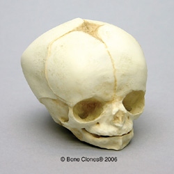 Human Fetal Skull 34 weeks