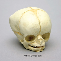 Human Fetal Skull 35 weeks