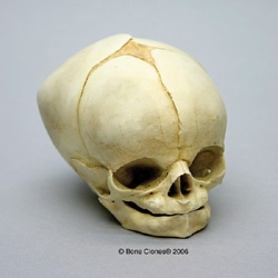 Human Fetal Skull 40 1/2 weeks (full term)