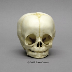 Human Child Skull 4-month-old (3-6 months)