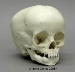 Human Child Skull 1-year-old (12-18 months) 