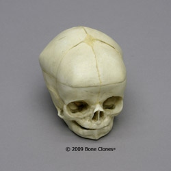 Human Fetal Skull 40 1/2 weeks (full term), Calvarium Cut