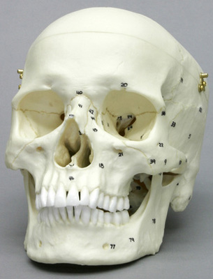 Human Male European Skull, Calvarium Cut, Numbered, with legend