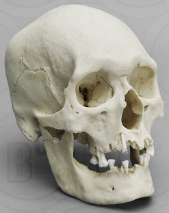 Human Male Polynesian Skull