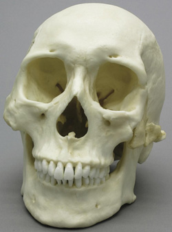Human Healed Blunt Force Trauma Skull