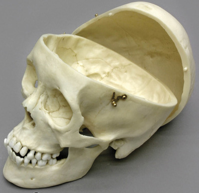 Human Adolescent Skull, calvarium cut