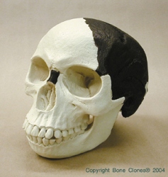 Piltdown Man Skull