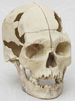 Homo sapiens Oase sagittal cut skull without reconstruction