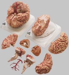 Gehirn mit Arterien