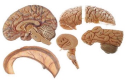 Brain model with falx cerebri