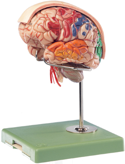 Brainmodell with Arteries, Falx Cerebri and Indicated Cytoarchitectural Areas