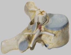 Thoracic Vertebra (TH II) with Spinal Cord