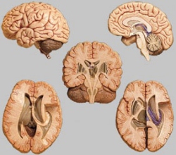 5 Section Models of the Brain