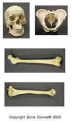 Economy set Male skull, pelvis,femur,humerus