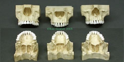 Comparative Human Maxilla, Set of 3 (African, Asian, European)