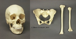 Comparative Set Human Female African-American- Skull, Pelvis, Humerus, Tibia