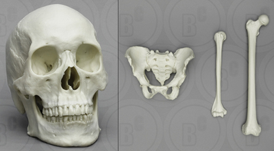 Comparative Economy set African-American Female: Skull, Pelvis, Femur, Humerus