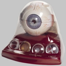 Cataract Eye Model