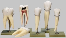 Fünf Zahnmodelle