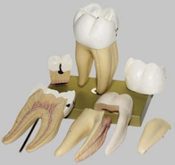 Right Lower First Molar