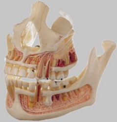 Upper and Lower Jaw