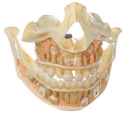 Set of Teeth of a 5-year-old child