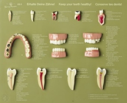 Case of Teeth