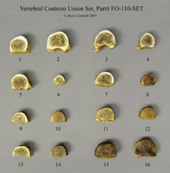 Vertebral Centrum Union Set - age series