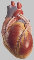 Model of the Heart with Bypass Vessels (Aortic Coronary Venous Bypass)